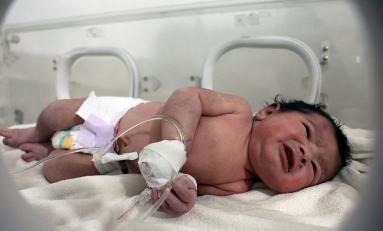 সিরিয়ায় ধ্বংসস্তূপে জন্ম নেওয়া শিশুটির নাম রাখা হলো আয়া