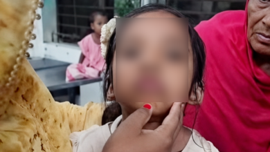 বিড়ালের আঁচড়ের পর শিশুর ‘মিউ মিউ’ শব্দ, কারণ জানালেন চিকিৎসক