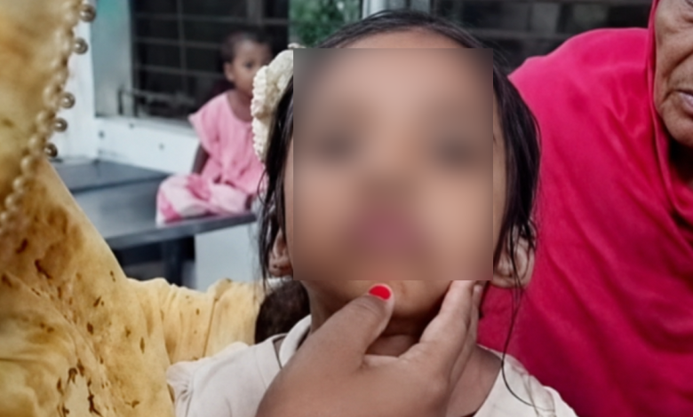 বিড়ালের আঁচড়ের পর শিশুর ‘মিউ মিউ’ শব্দ, কারণ জানালেন চিকিৎসক